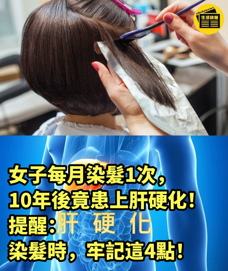 女子每月染髮1次，10年後竟患上肝硬化！提醒：染髮時，牢記這4點