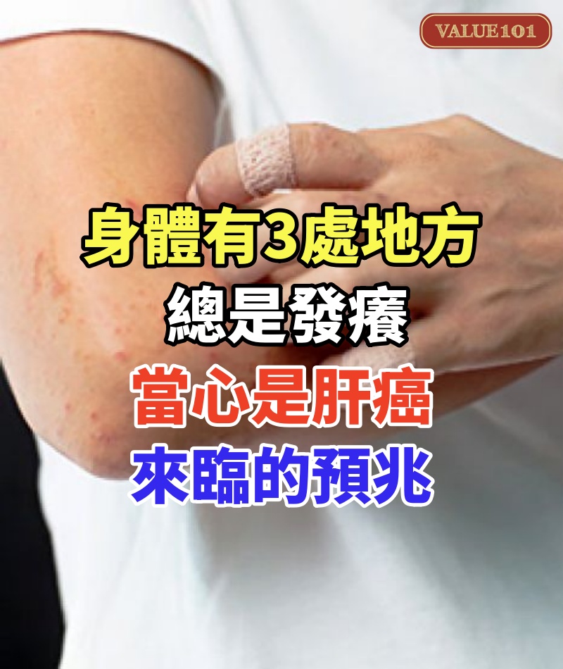 身體有3處地方總是發癢,別以為是皮膚病,當心是肝癌來臨的預兆