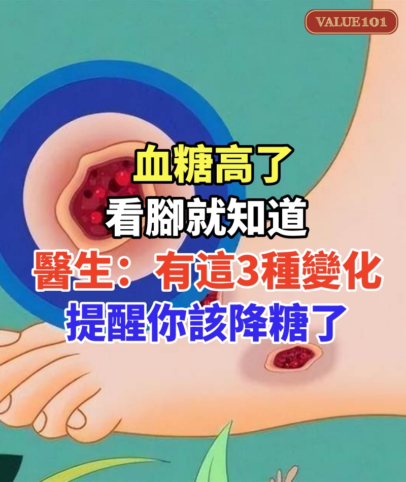 血糖高了,看腳就知道,醫生:腳部有這3種變化,提醒你該降糖了