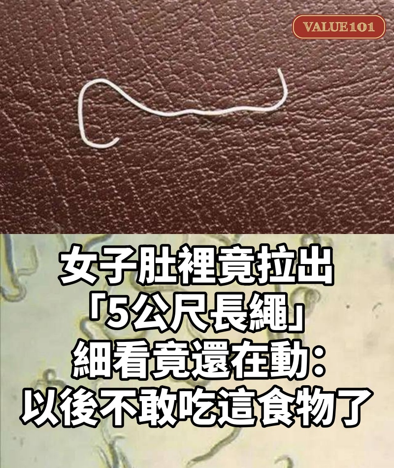 女子肚裡竟拉出「5公尺長繩」!細看竟還在動:以後不敢吃這食物了...