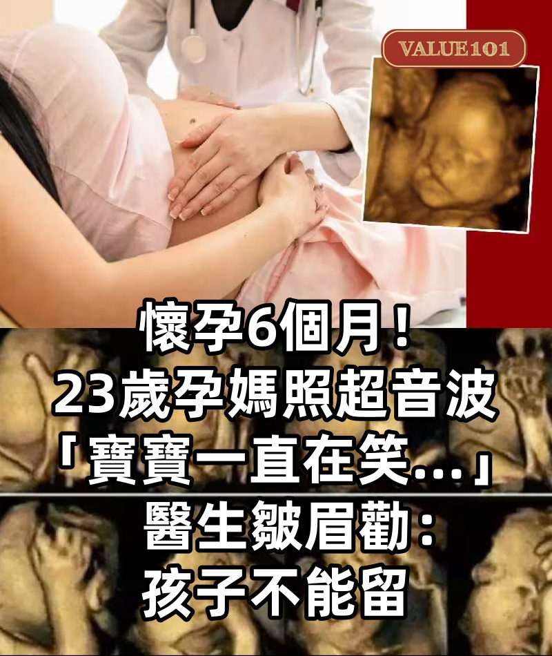 懷孕6個月！23歲孕媽照超音波「寶寶一直在笑...」　醫生皺眉勸：「孩子不能留」