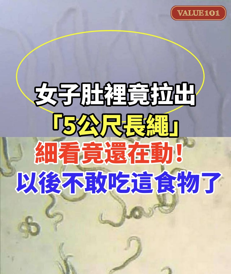 女子肚裡竟拉出「5公尺長繩」!細看竟還在動:以後不敢吃這食物了...