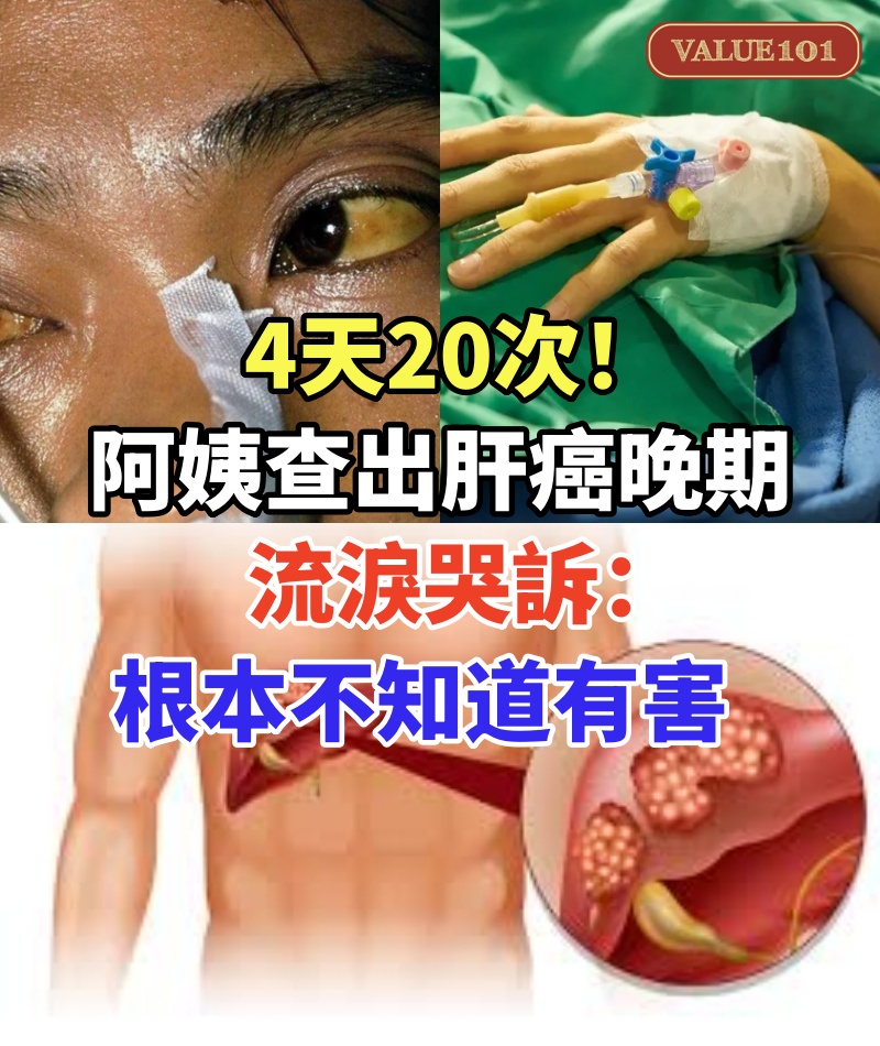 4天20次!60歲阿姨查出肝癌晚期,流淚哭訴:根本不知道有害