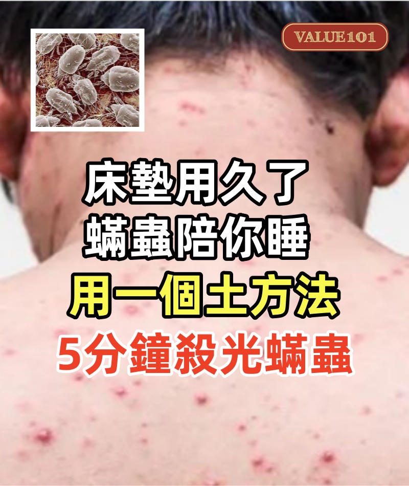 床墊用久了,數百萬隻蟎蟲陪你睡!用一個土方法,5分鐘殺光蟎蟲!不用洗,也不用曬!