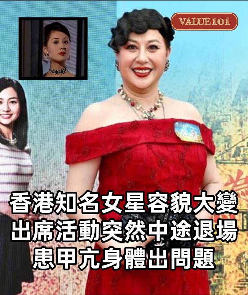 香港知名女星容貌大變,出席活動突然中途退場,患甲亢身體出問題