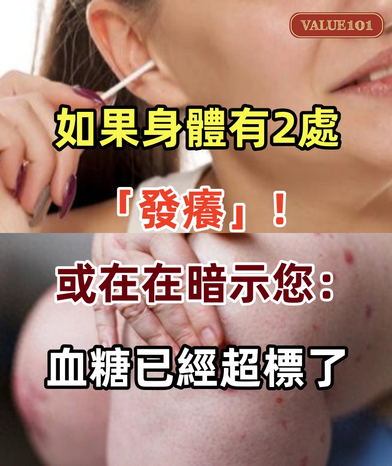 如果身體有2處「發癢」，或在在暗示您：血糖已經超標了